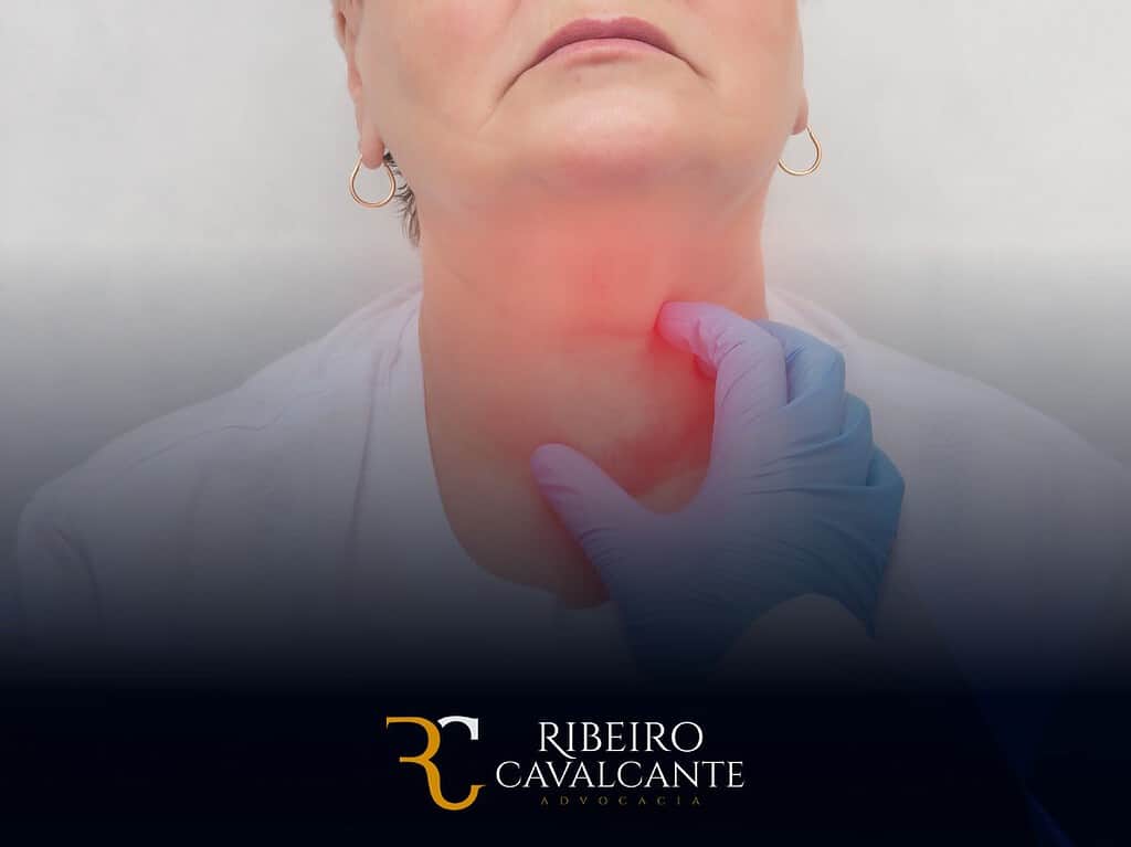 Câncer de cabeça e pescoço BPC-LOAS