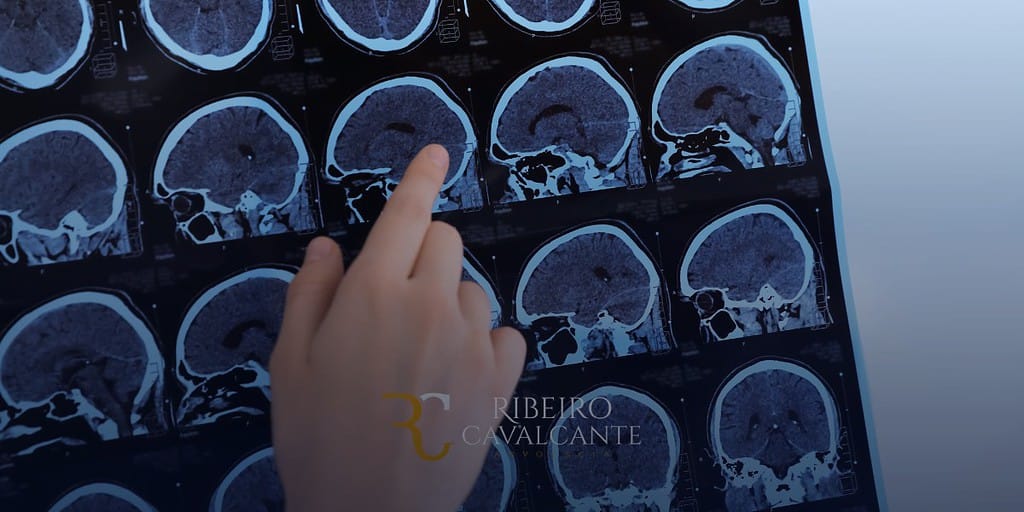 Mão apontando para uma imagem de ressonância magnética de cérebro. Análise neurológica no Instituto Ribeiro Cavalcante.