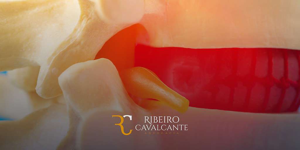Imagem de modelo anatômico de coluna vertebral com logo do escritório de advocacia Ribeiro Cavalcante em destaque.