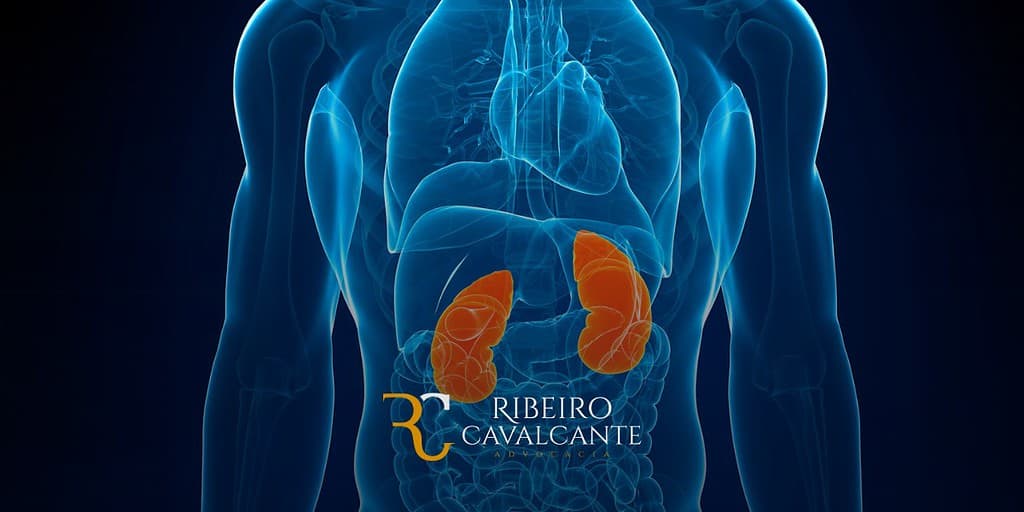 Neuropatia Periférica Grave, auxílio-doença, aposentadoria por invalidez, Ribeiro Cavalcante Advocacia