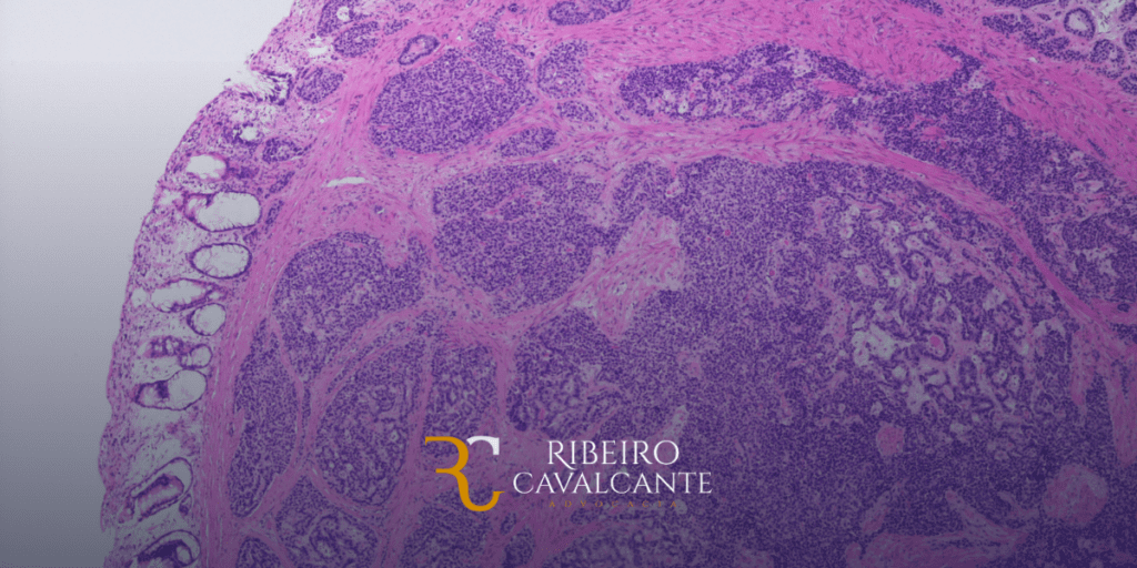Imagem de lâmina histológica com tecidos corados, com logotipo e nome Ribeiro Cavalcante Advogados no canto inferior direito.