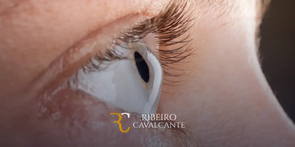 aposentadoria por invalidez para ceratocone