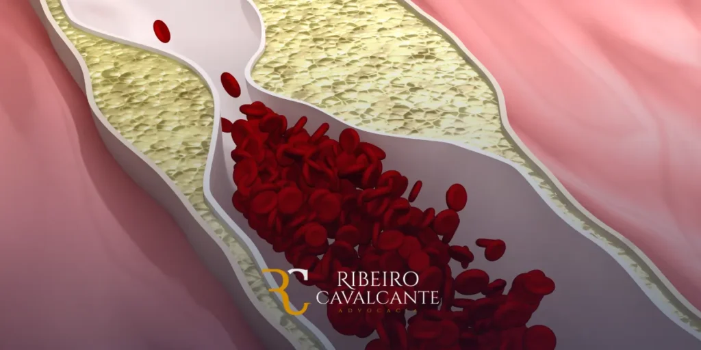 Critérios para concessão do BPC para DAOP