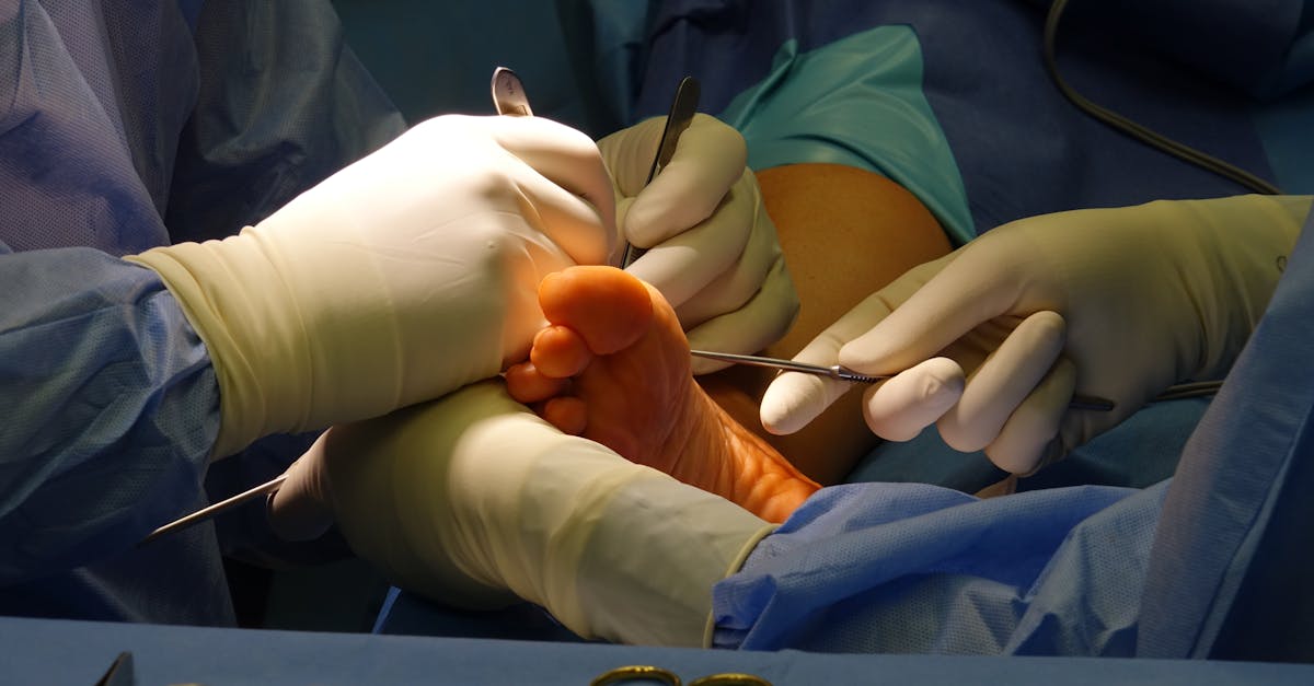 Close de mãos de cirurgiões usando luvas e instrumentos médicos durante uma operação em centro cirúrgico. — Foto: Viktors Duks