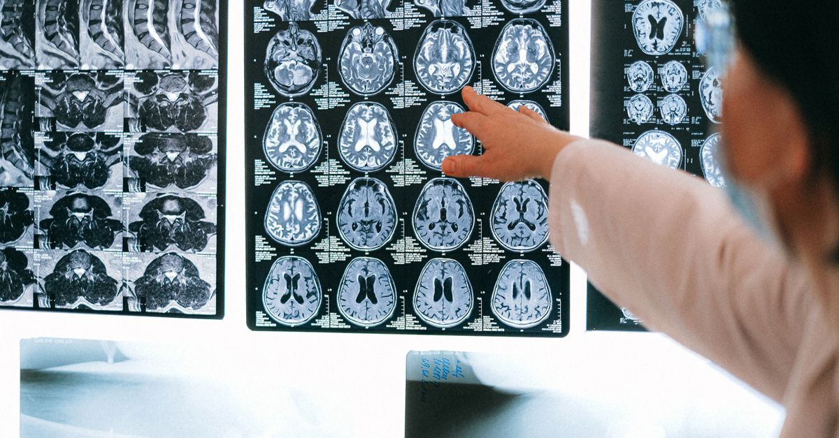 Cid s06 traumatismo cranioencefalico afastamento auxilio doenca e aposentadoria inline 1 527203 1785694613 Pessoa apontando para exames cerebrais em um ambiente médico.