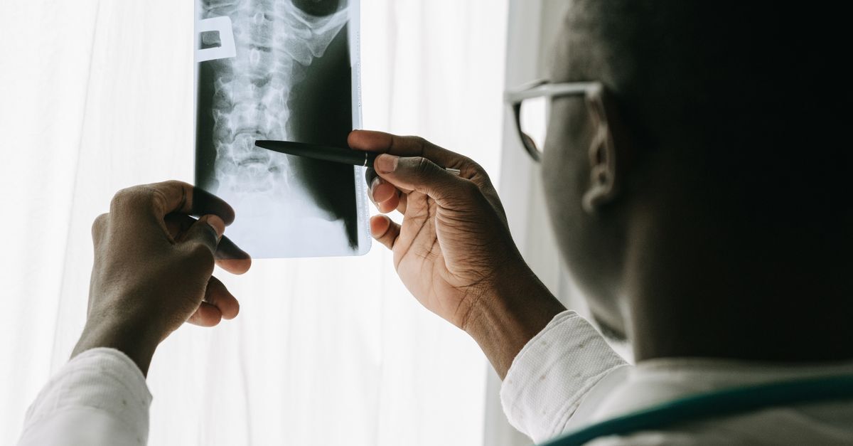 Cid s32 fratura da coluna lombar afastamento auxilio doenca e aposentadoria inline 1 525832 1785676557 Médico analisando uma radiografia da coluna vertebral.