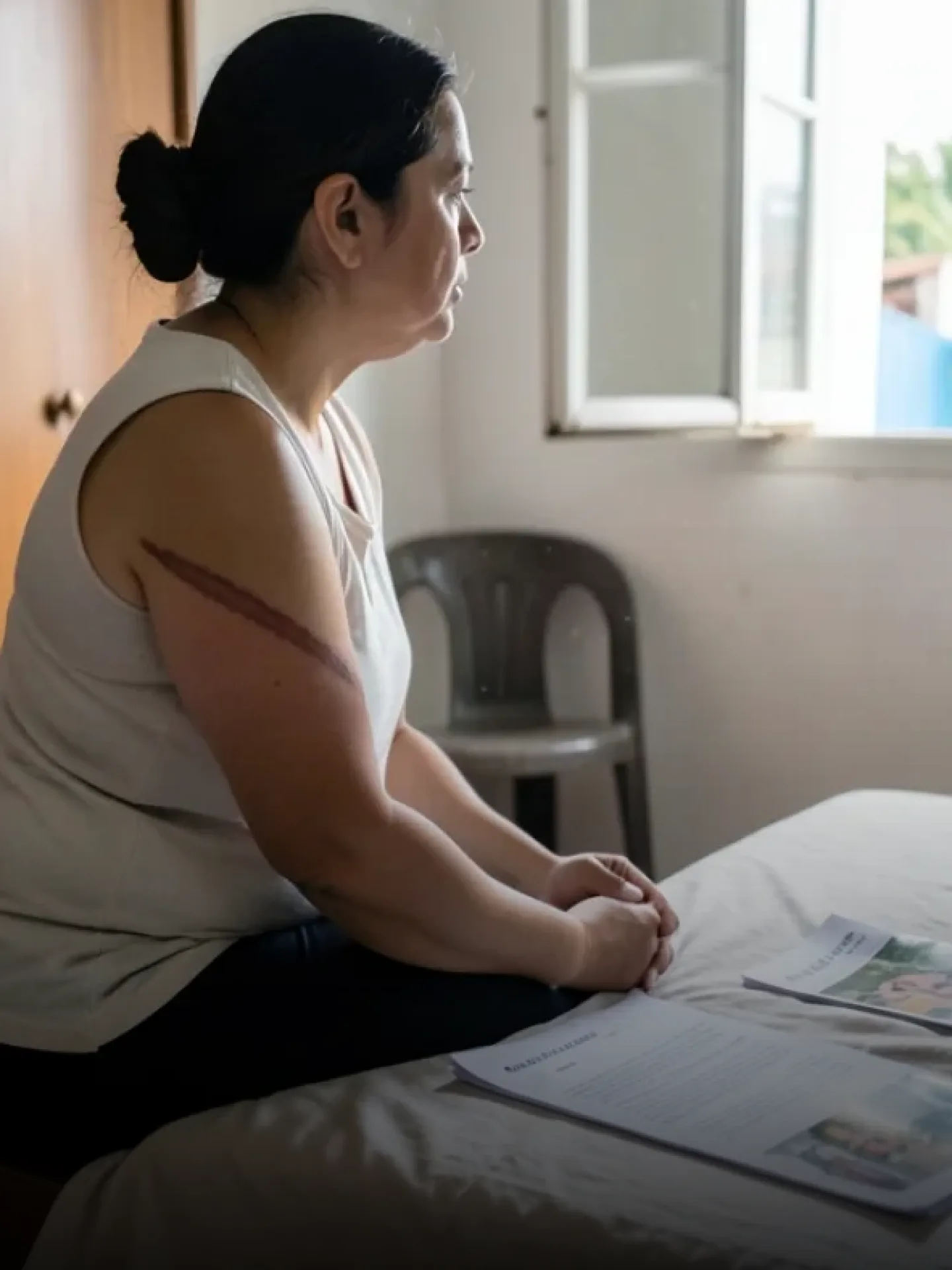 Dano estético e moral somam: Súmula 387 do STJ
