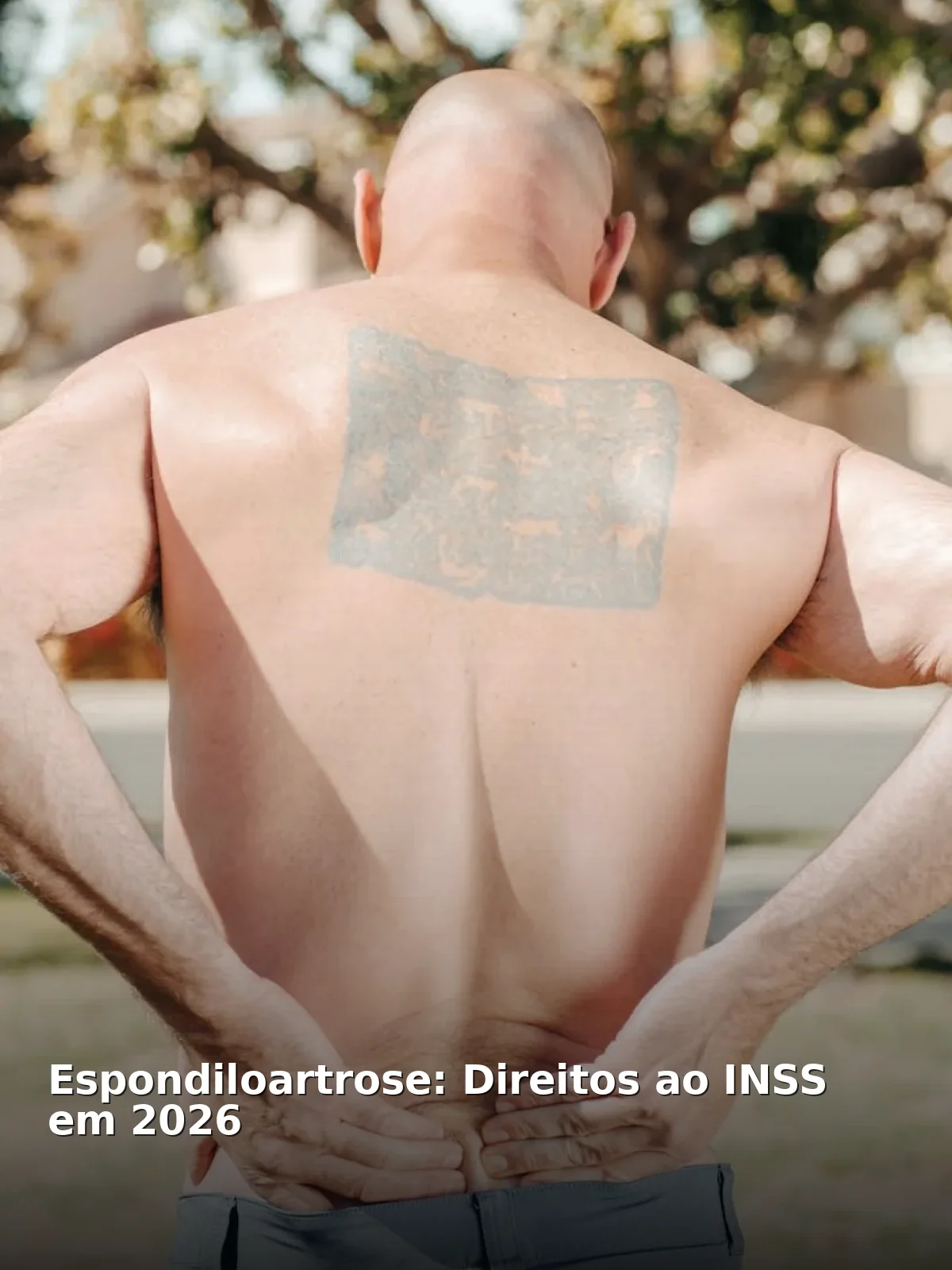 Espondiloartrose: Direitos ao INSS em 2026